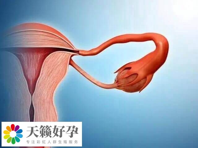 大的卵巢囊腫要先進(jìn)行治療