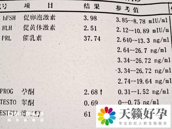 男性做試管檢查前要注意空腹