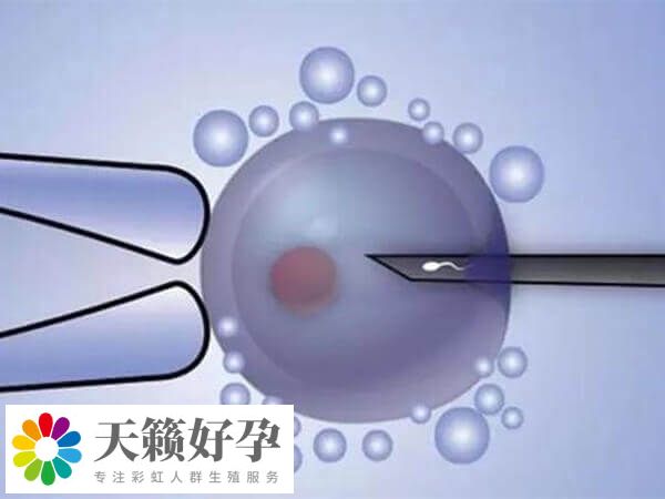 養(yǎng)囊有一定優(yōu)勢(shì)