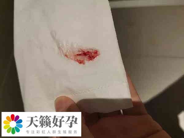 試管移植后出血是著床出血