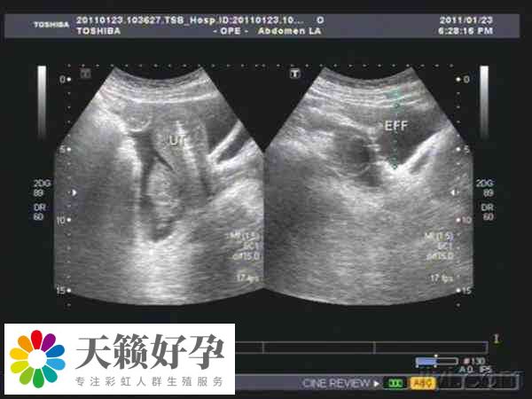 促排數量多有助于提高成功率