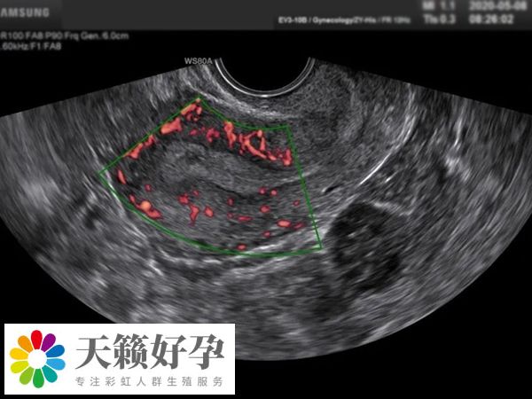 男性需要進行睪丸超聲檢查
