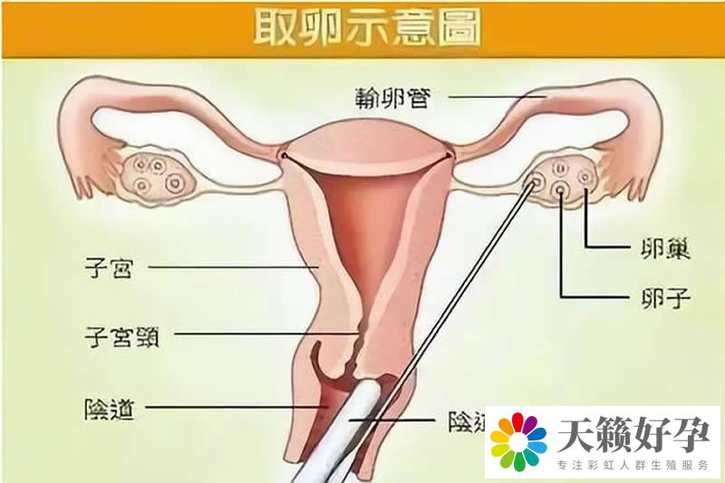 天鋒試管
